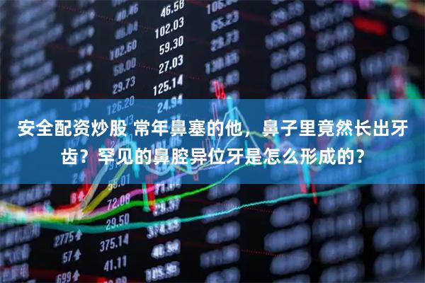 安全配资炒股 常年鼻塞的他，鼻子里竟然长出牙齿？罕见的鼻腔异位牙是怎么形成的？